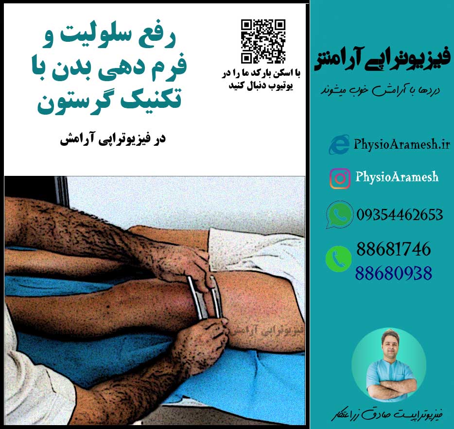 مركز درمان سلوليت در تهران